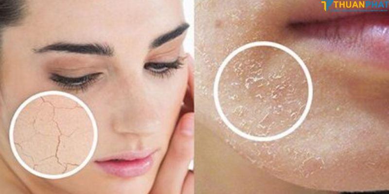 . Vì sao điều hòa khiến da bị khô . Vì sao điều hòa khiến da bị khô